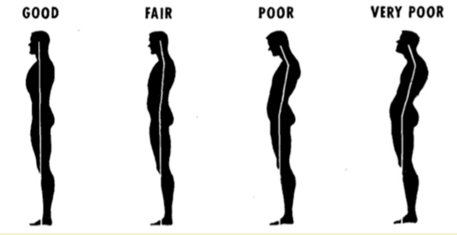 Why is it painful to have good posture? - Roots Health Clinic